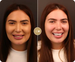 Alina B. Before & After