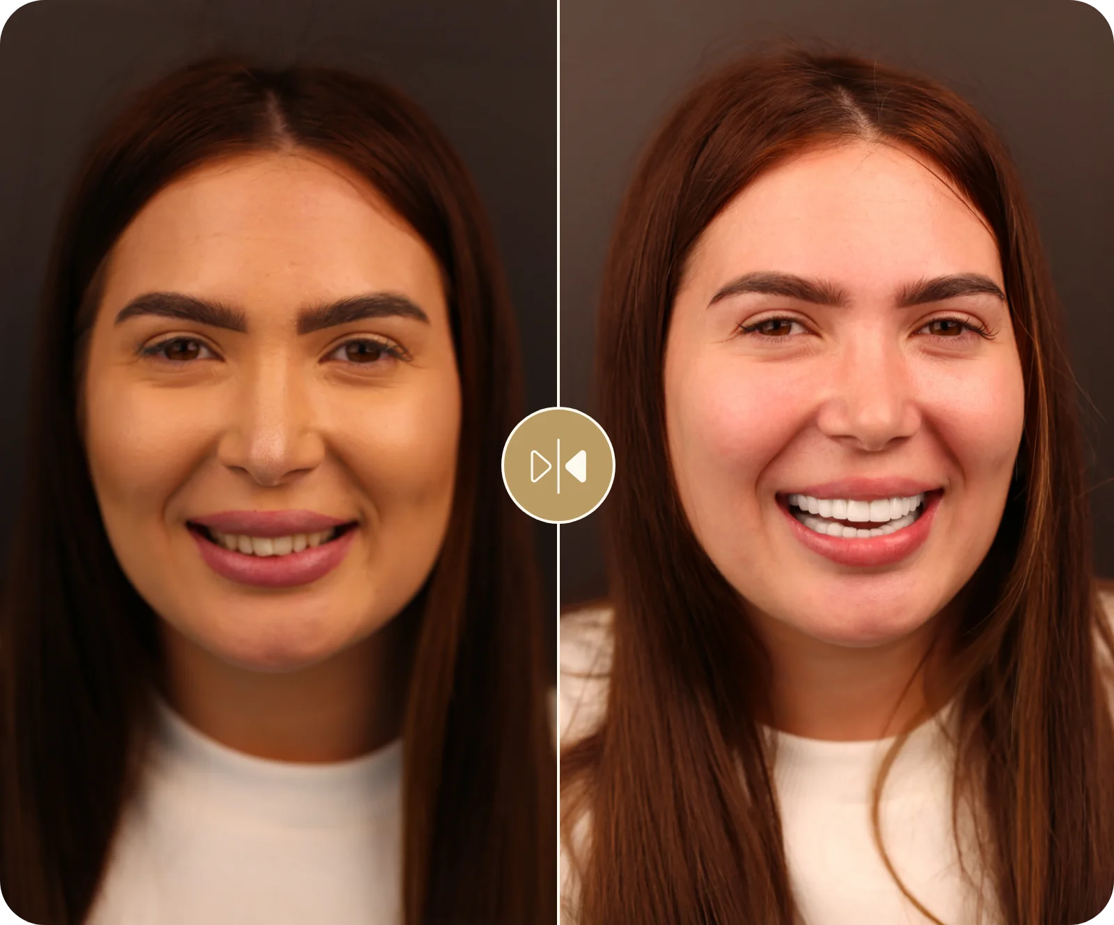 Alina B. Before & After