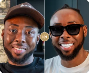 Efe Tommy Before & After