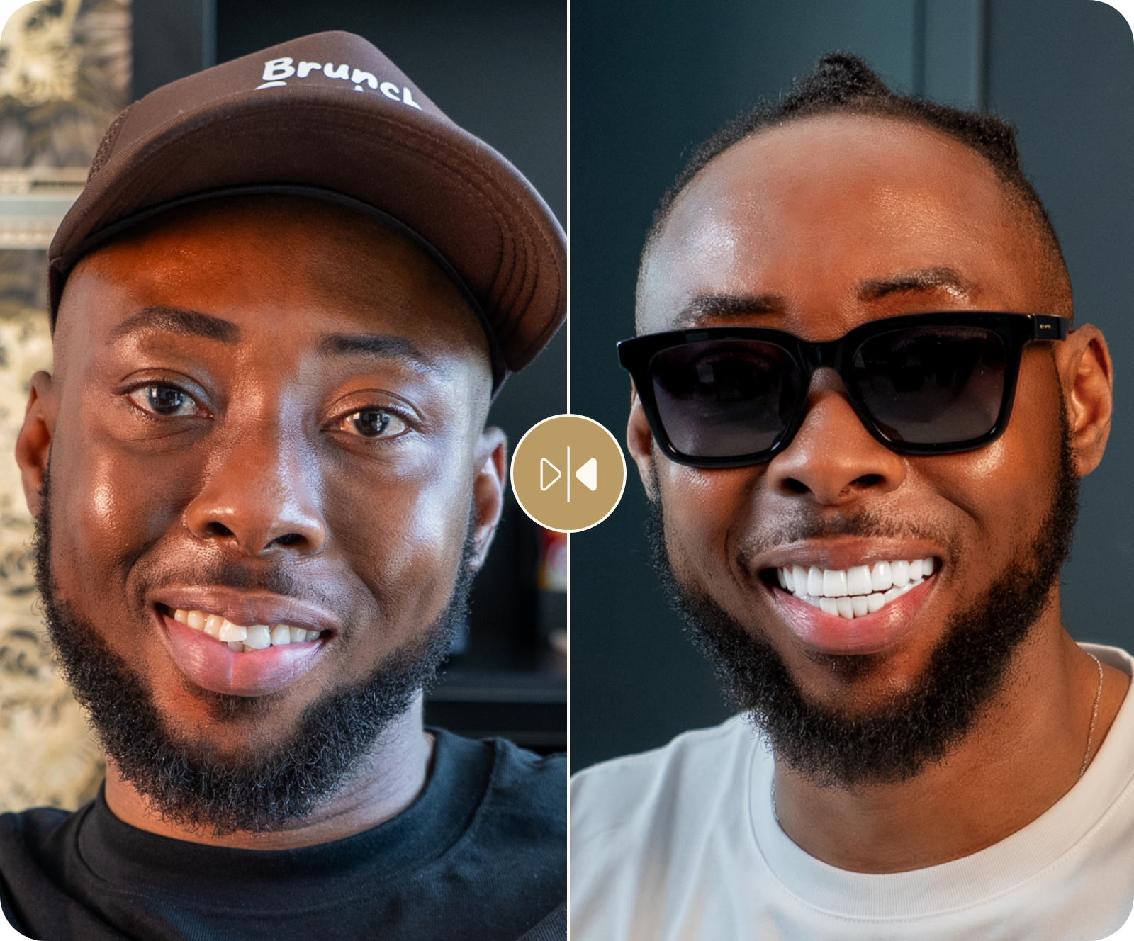 Efe Tommy Before & After