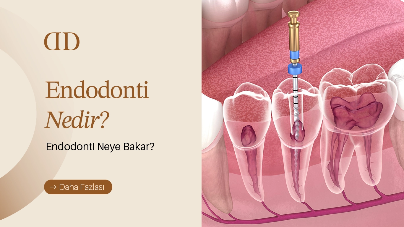 endodonti