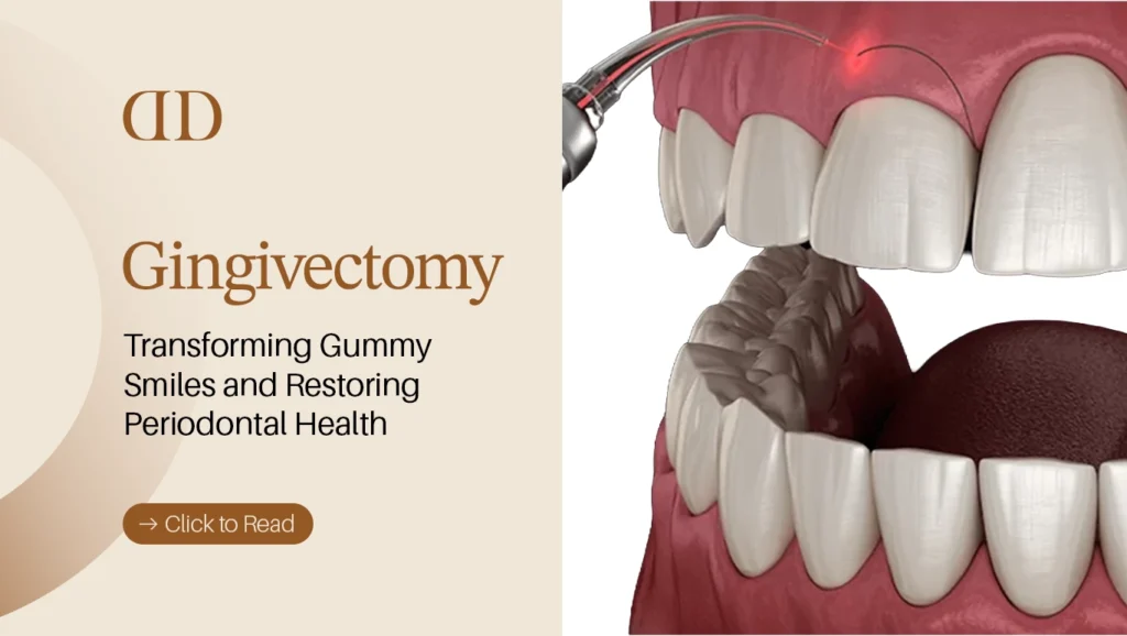 gingivectomy