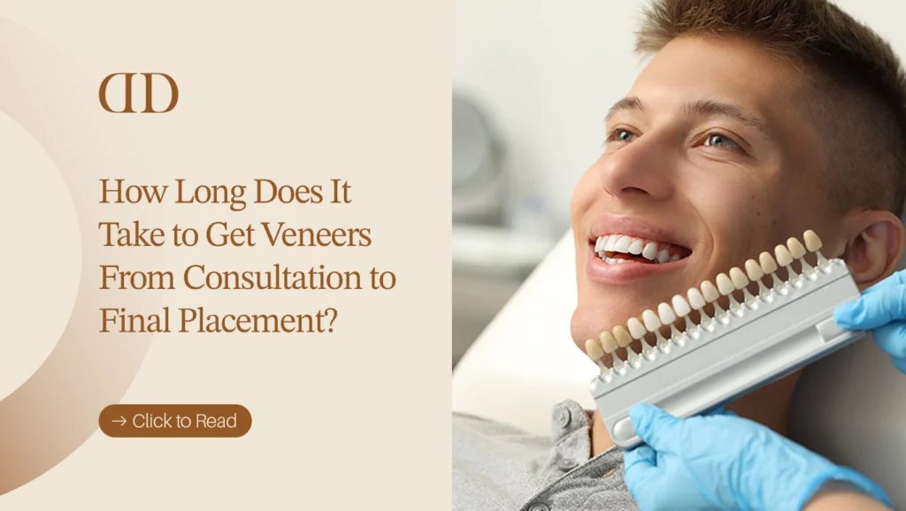 Dental veneer treatment timeline from consultation to placement