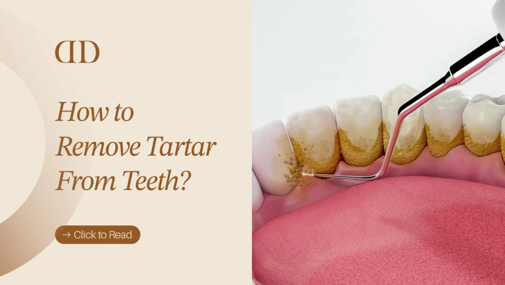 Illustration showing how to remove tartar from teeth using proper oral hygiene methods