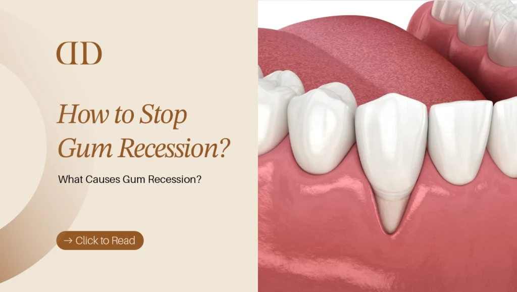before and after view showing how to stop gum recession