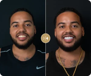 Joshua Before & After