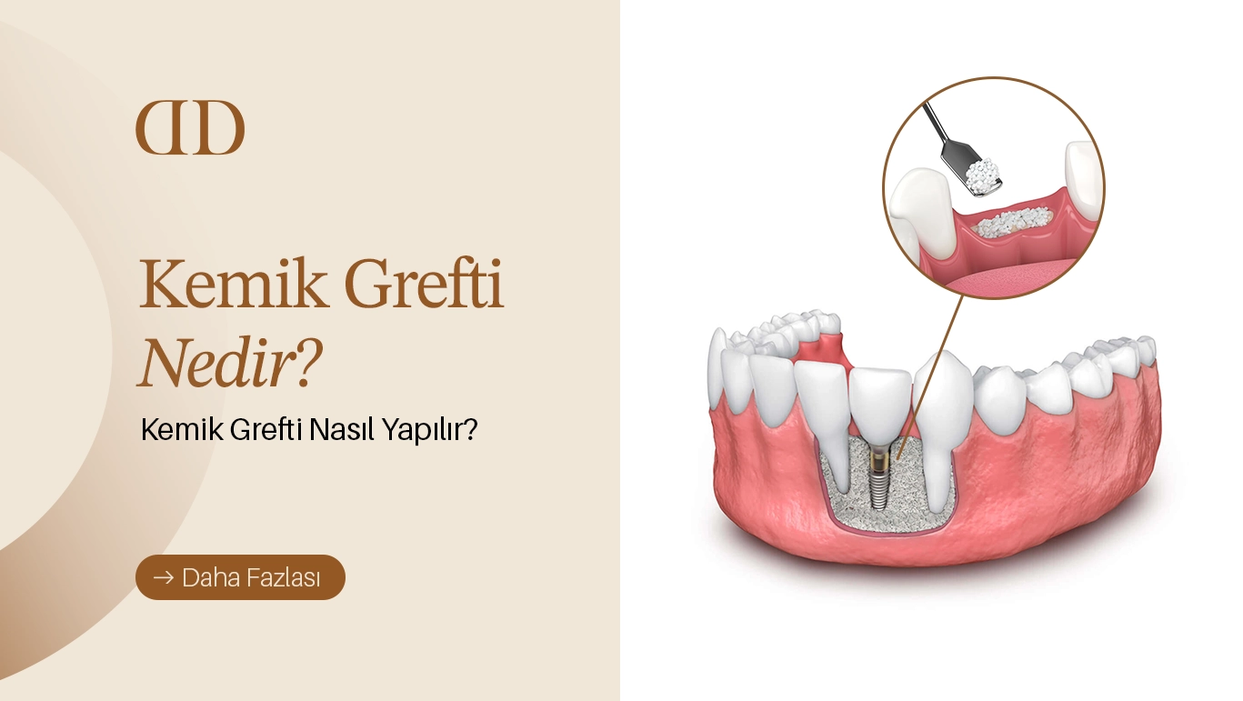 kemik grefti