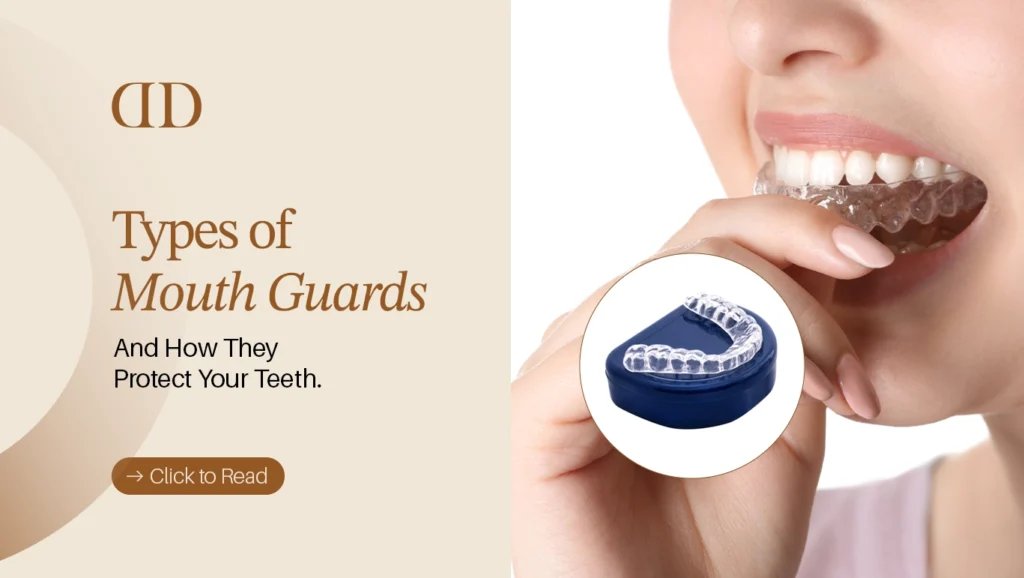 Mouth Guards