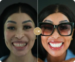 Khanyi Mbau Before & After
