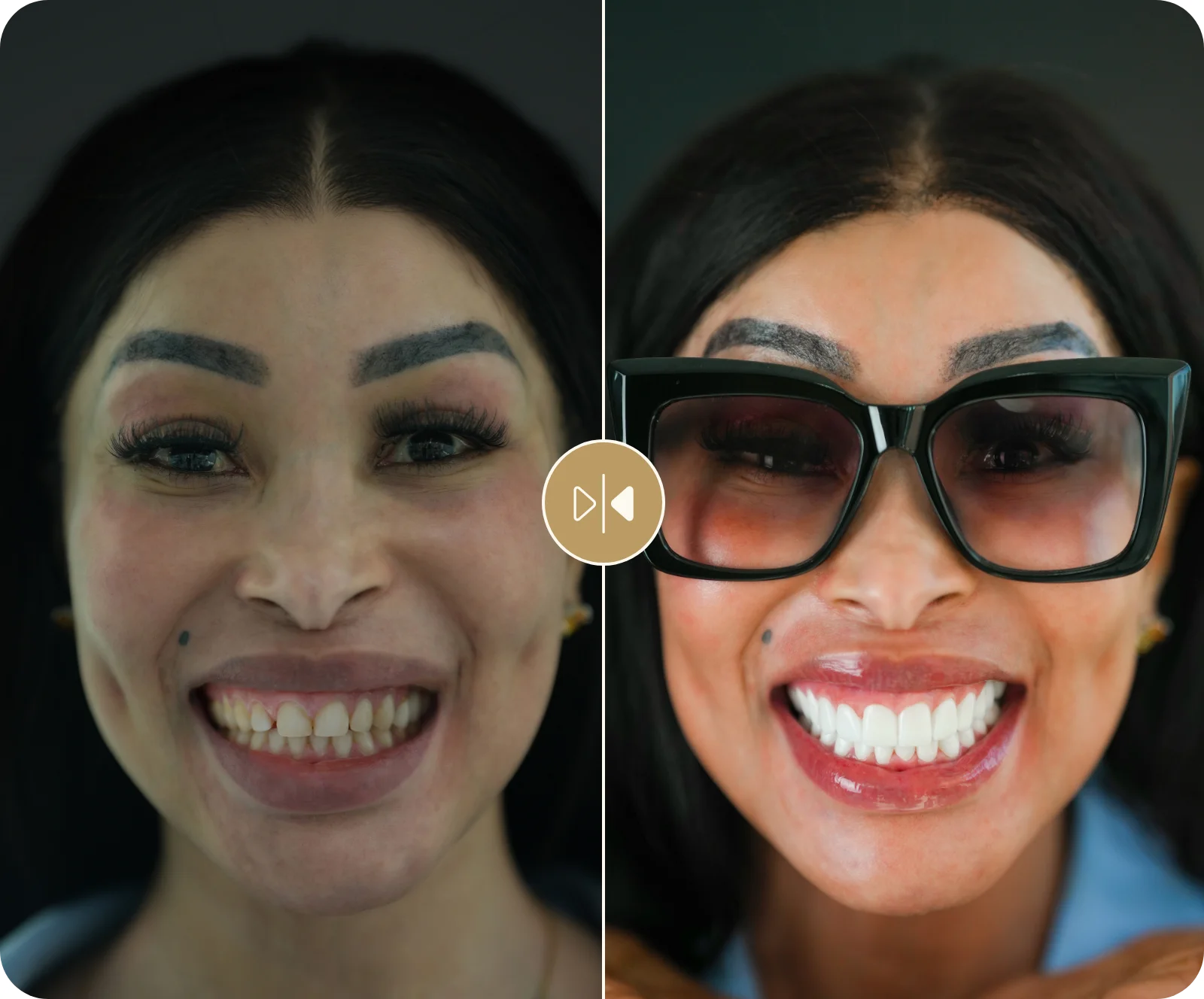 Khanyi Mbau Before & After