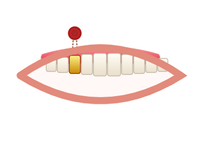 Before Root Canal Treatment