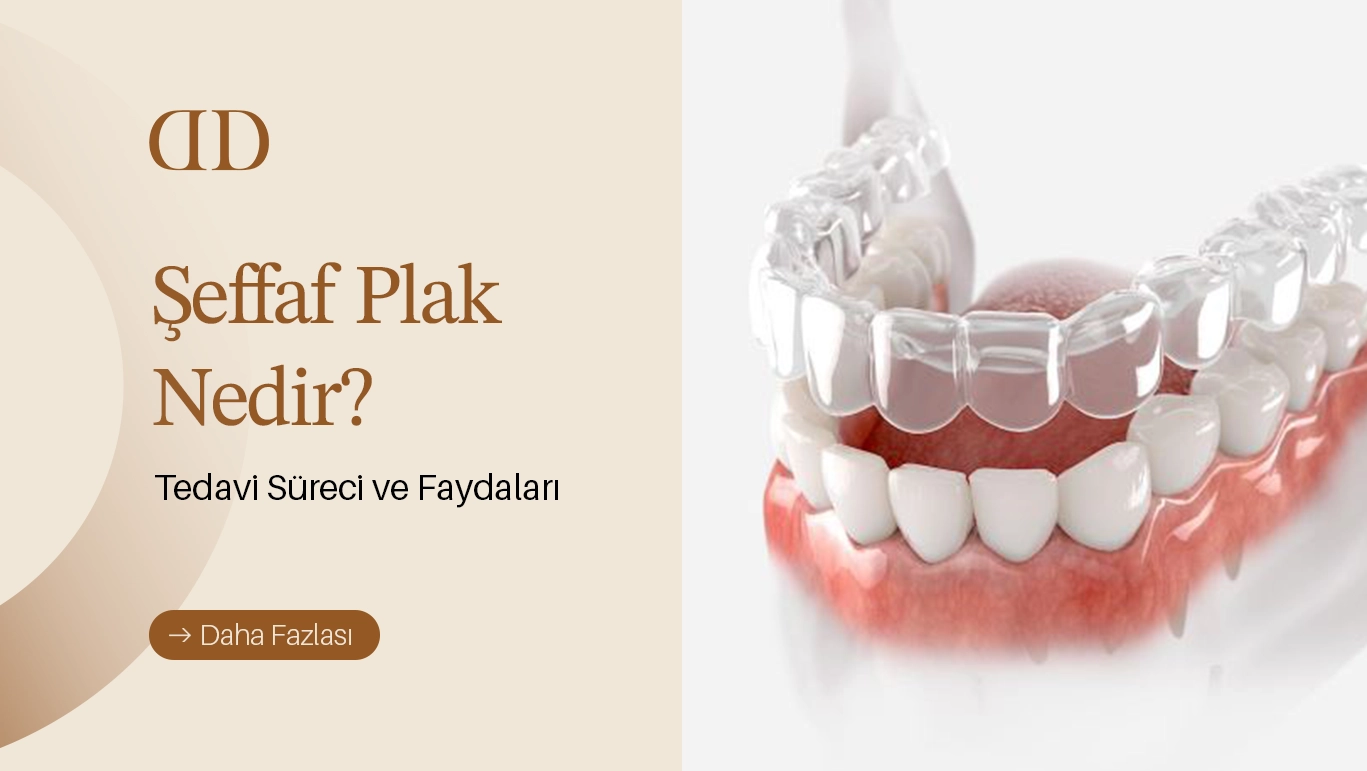 Şeffaf Plak