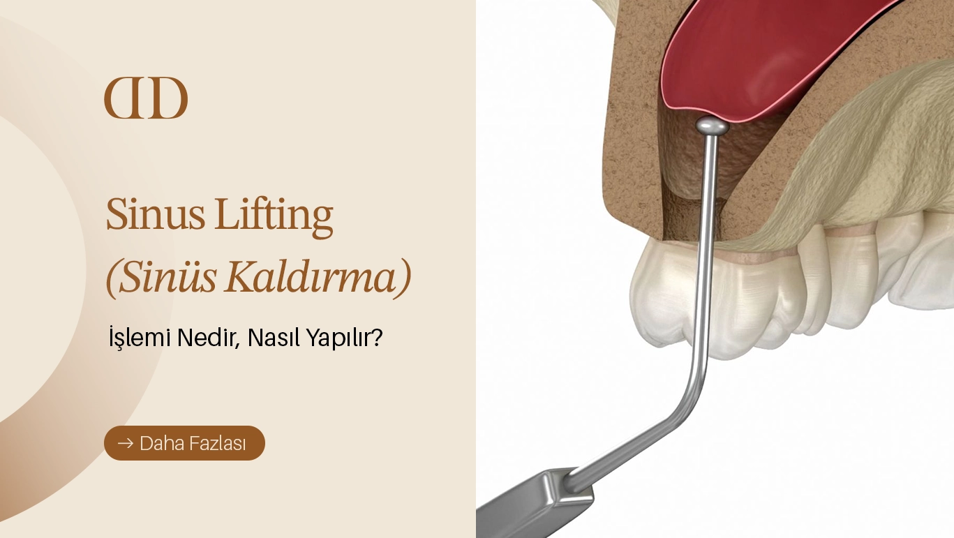 Sinus Kaldırma