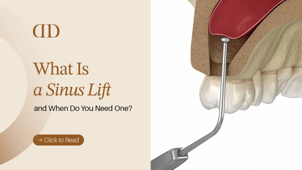 Sinus Lift