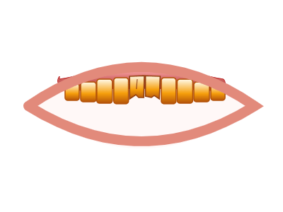 Before Smile Makeover