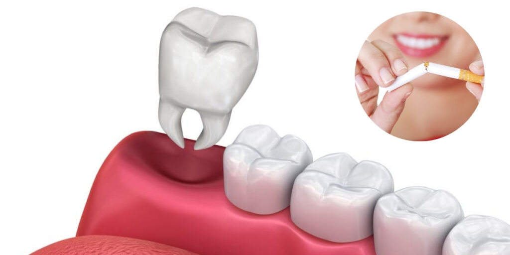 Smoking after tooth extraction and its effect on healing