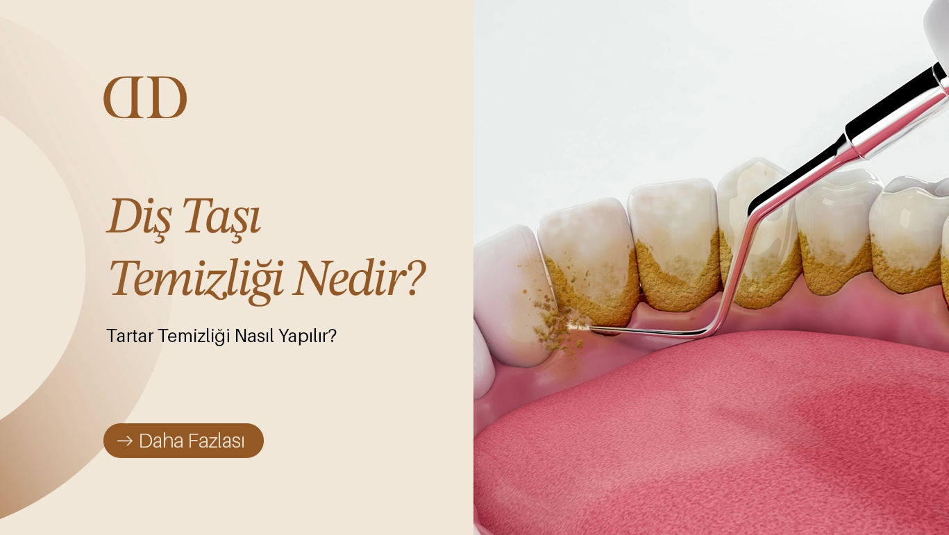 Diş taşı temizleme yöntemlerini gösteren dental görsel