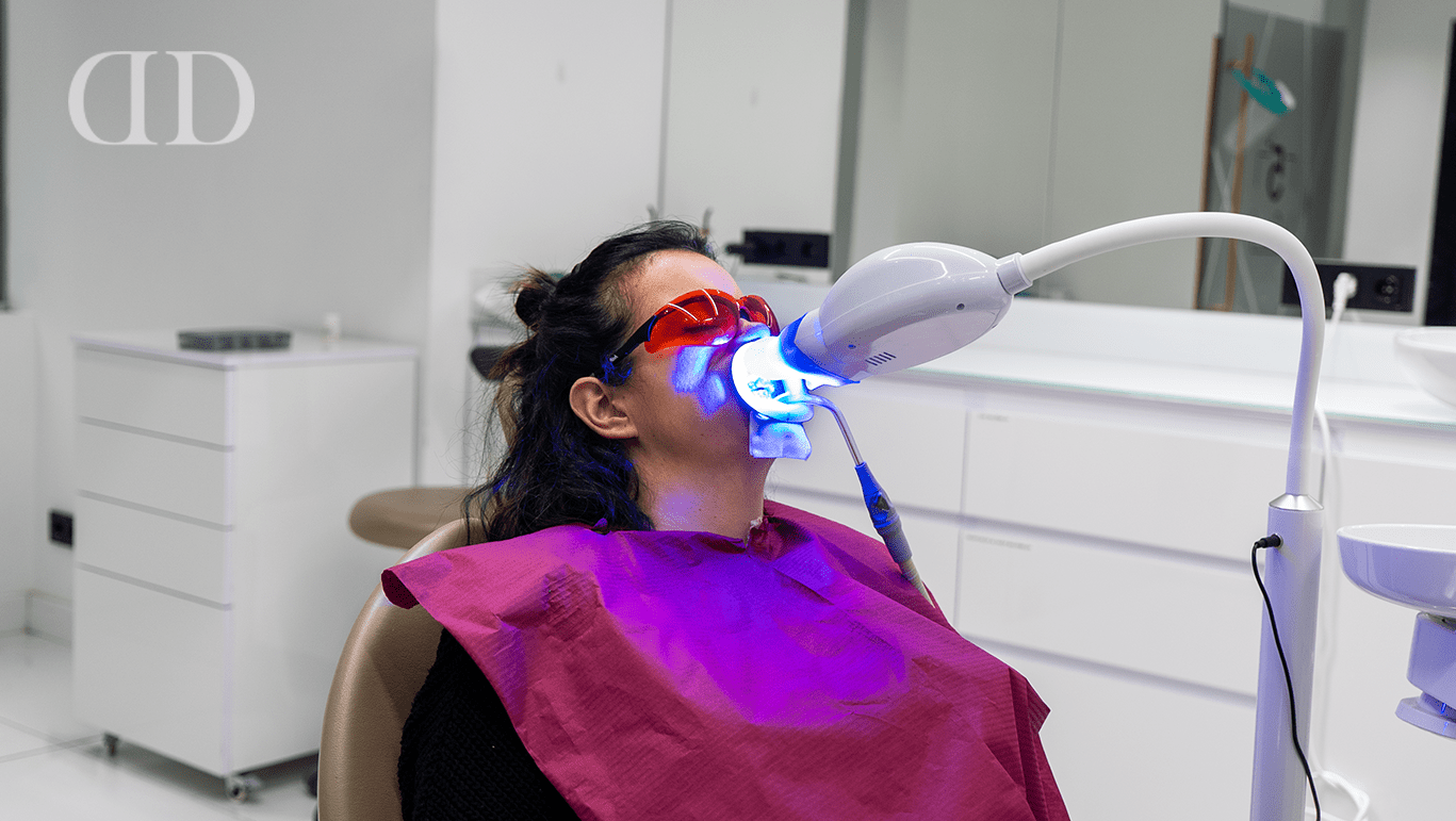Teeth whitening before veneers or dental crowns