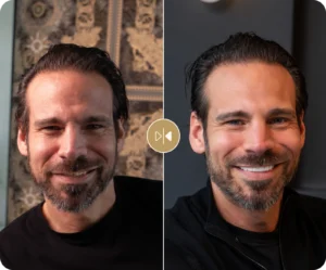 Vladimir Before & After
