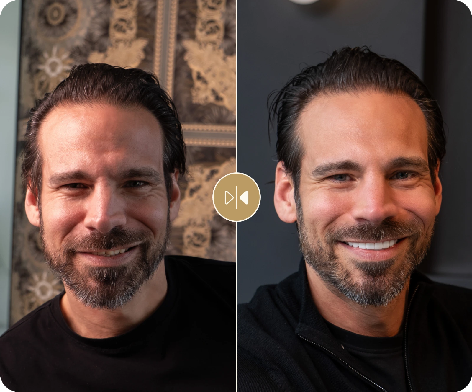 Vladimir Before & After