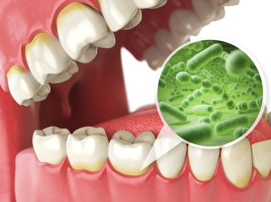 Oral Bacteria