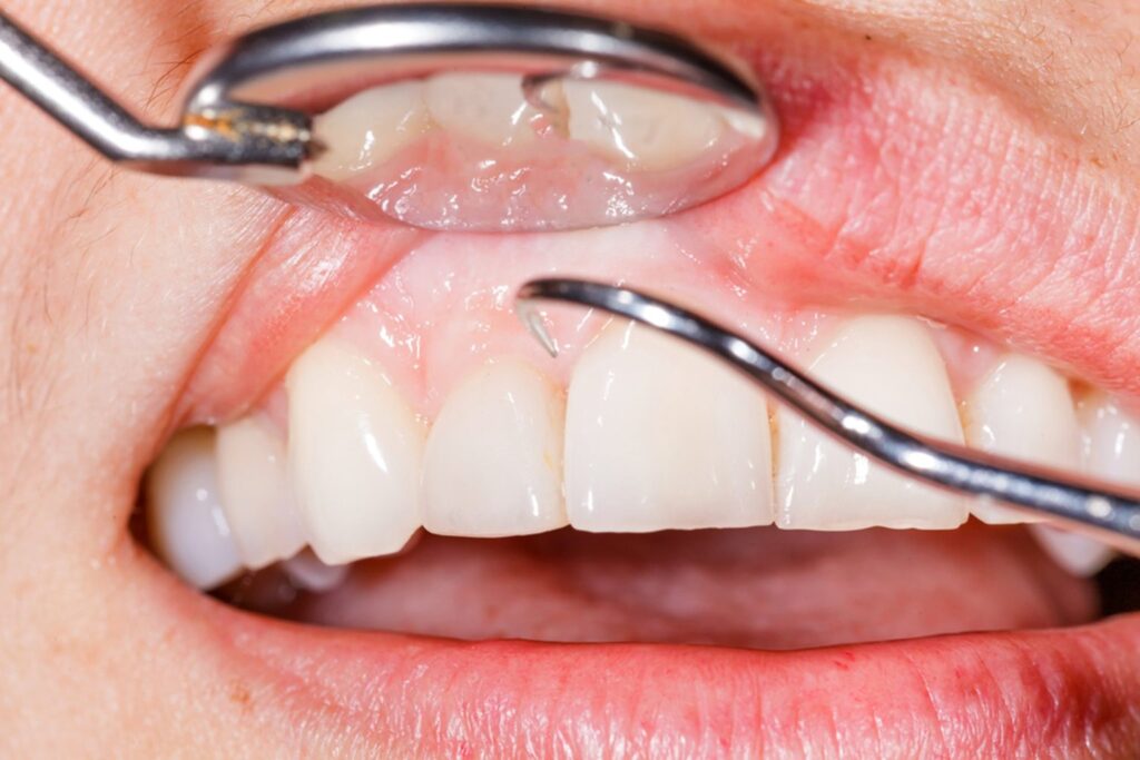 periodontist