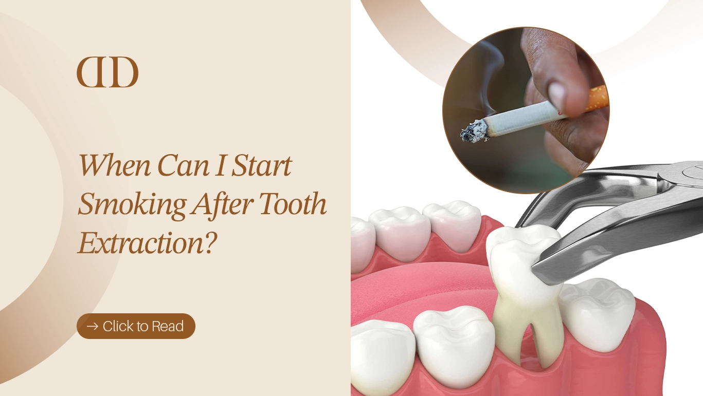 When can I start smoking after tooth extraction without complications